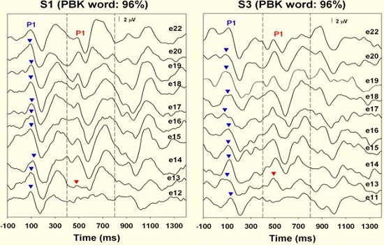Spectral resolution results from good word recognition performers