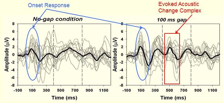 Standard condition with no gap versus the gap condition showing the P1 response at approximately 500 ms