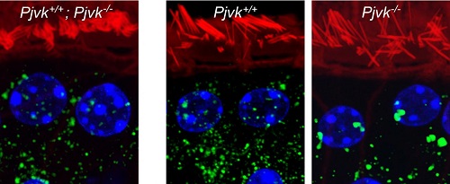 Sound exposure induces a proliferation of peroxisomes in the auditory sensory cells of mice