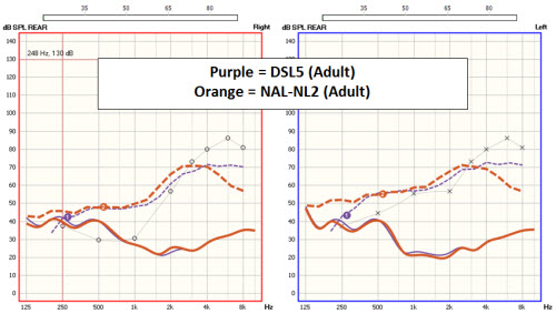 DSL 5.0 and NAL-NL2 fitting target comparisons for a soft input