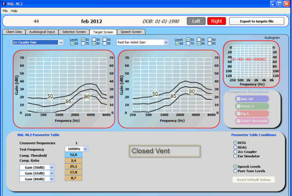 Targets for 2cc coupler gain compared to real ear aided gain in closed vent