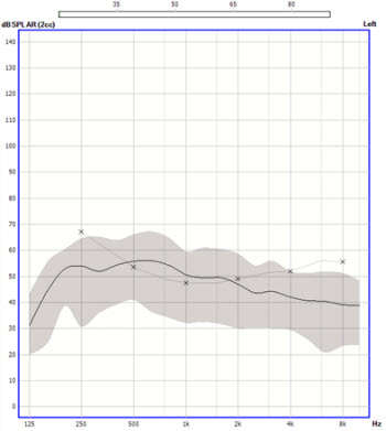 Speech banana for a 65 dB average International Speech Test Signal