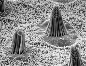 Inner ear hair cells