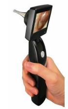 MD Scope handheld video otoscope with LED screen