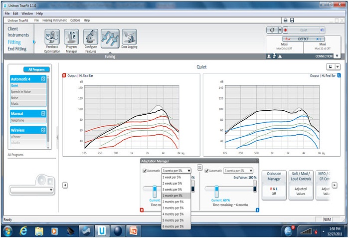 Unitron automatic adaptation manager