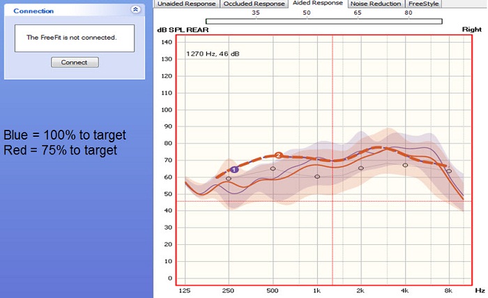 Matching 75% versus 100% of target in the Unitron fitting software in an open-fit hearing aid