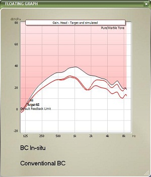 Example of large gain differences prescribed by BC in-situ and conventional audiometry for a 25 year-old man with aural atresia