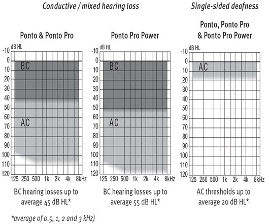 Ponto fitting ranges