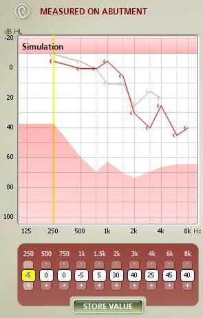 Difference in hearing threshold between traditional bone-conduction and BC in-situ measures