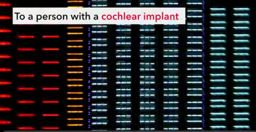 Graphic showing improvement in clarity and level of speech from cochlear implants