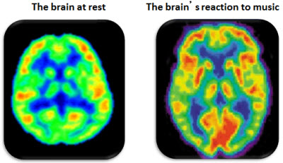 Brain at rest versus when listening to music 