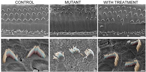 Sensory hair bundles in mice