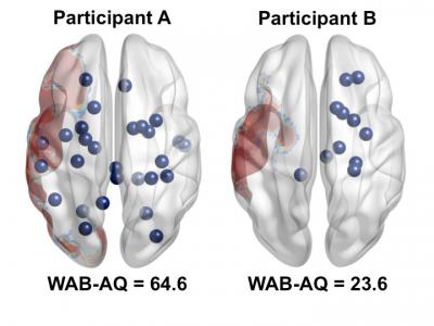 Two representative participants demonstrate the relationship between number of rich club nodes in each hemisphere and language performance