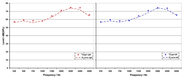 Average NAL-NL 2 target and real ear output for right and left ears for 20 subjects