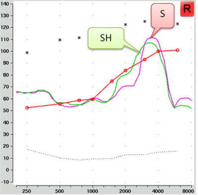 Aided sh and s as recorded through a hearing aid using live voice as the test signal