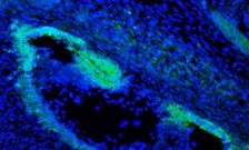 Early developmental step in the formation of the mammalian middle ear