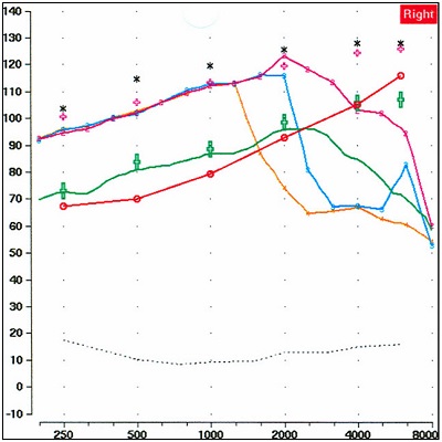 Example illustrating that the farther the test frequency is from the start frequency, the greater the mismatch