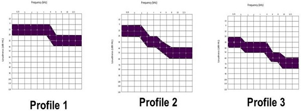 Sanctuary fitting profiles