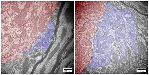Synapse formed by the auditory nerve in a normal mouse