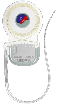 SYNCHRONY cochlear implant