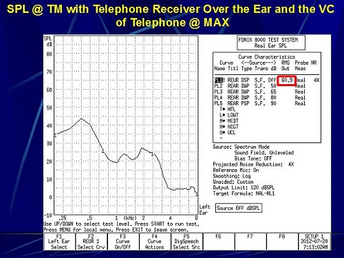 Sound pressure level at the eardrum with the telephone receiver over the ear and the volume of the telephone set to maximum