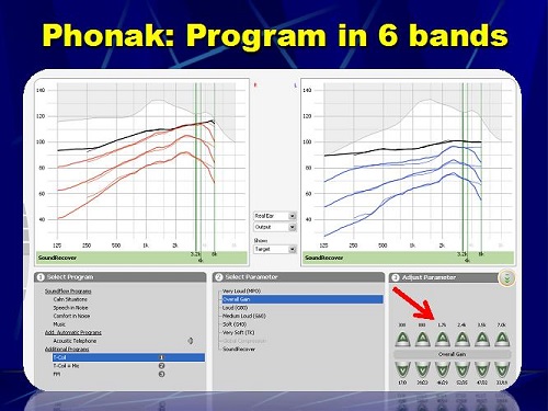 Phonak software screen shot to program overall gain in the telecoil