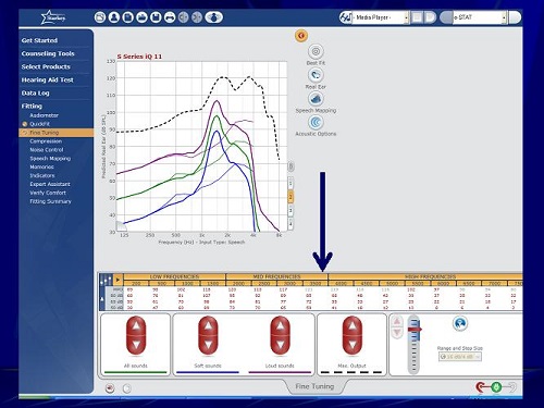 Starkey software screen shot to program overall gain in the telecoil with several frequency bands