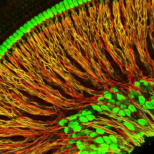 Spiral ganglion neuron projections from an isolated portion of a mouse cochlea