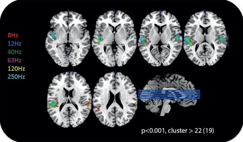 Activation of the auditory cortex during stimulation of the ear by low-frequency sound and infrasound