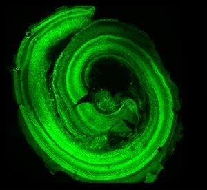 the cells of the inner ear responsible for detecting sound and transmitting those signals to the brain