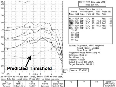 Typical real-ear screen output of a Fonix 7000 system