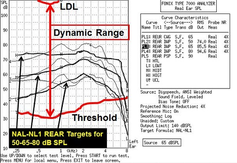 Dynamic range between threshold and LDL