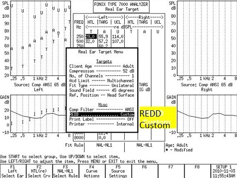 Real Ear Target menu of the Fonix 7000 system