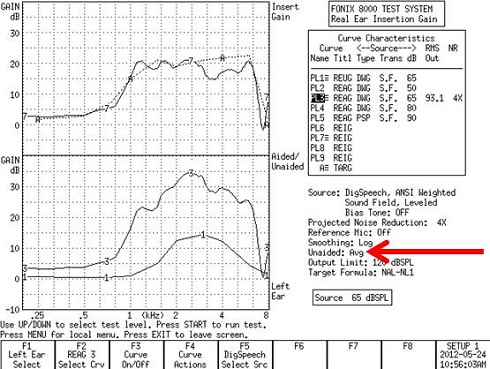 Fonix 8000 REIG curves using the average unaided gain responses