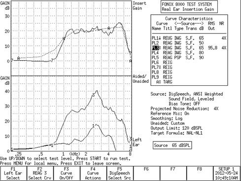 Fonix 8000 REAG curves using the custom responses