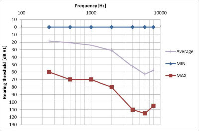 Audiometric range for the participants in the trial