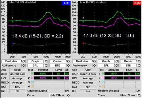 Left and right ear verifications of ER-15 flat frequency attenuators