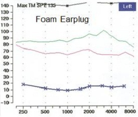 Ear canal resonance of an ear occluded with a foam earplug compared to the open ear response