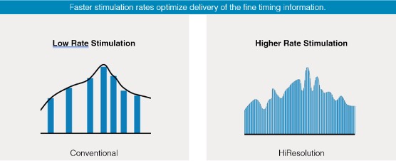Low Vs. High Stimulation Rate