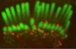 Immunofluorescence of TMC1 in confocal images of rat inner hair cell and outer hair cell stereocilia