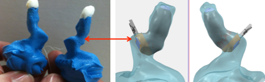 Inspect the impressions to evaluate the anatomy and recommendations for the patient