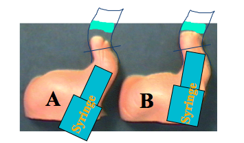 Two pictures show differences in the outcomes of impressions depending on where the tip of the syringe is pointed in the canal