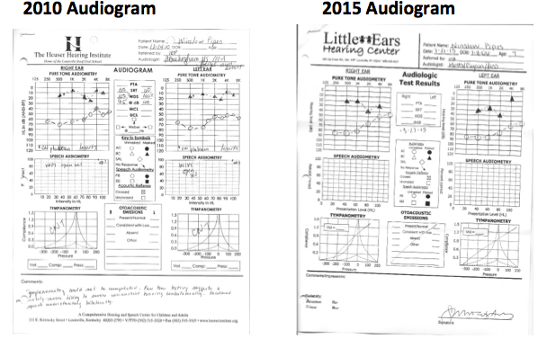 Winslow’s audiogram