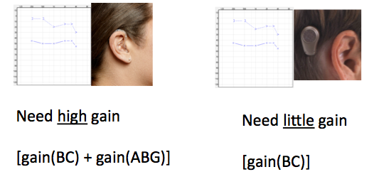 Gain requirements for a traditional hearing aid versus a bone anchored hearing system for the same audiogram