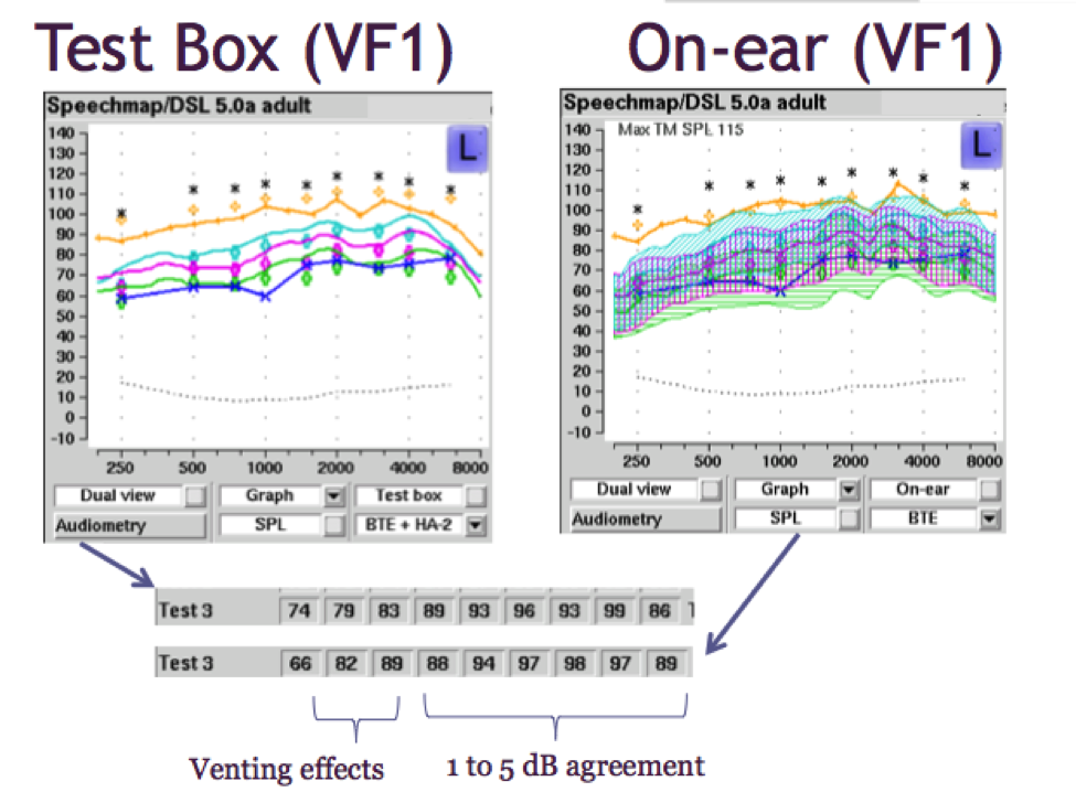 Test box versus on-ear verification for a BTE using Verifit 1