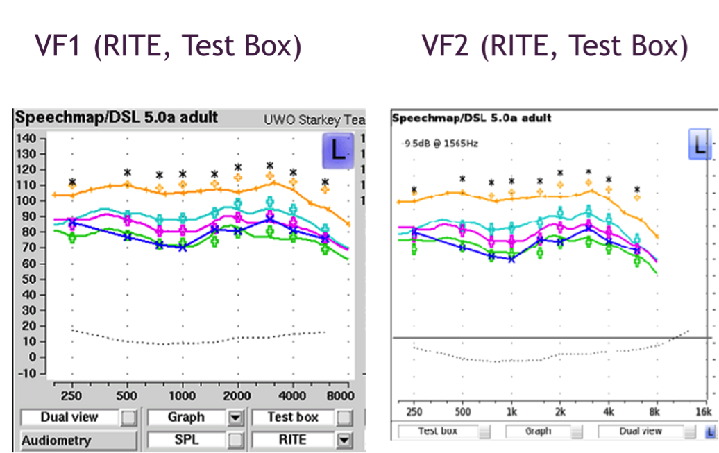 Test box verification of RITE hearing aid using Verifit 1 and Verifit 2