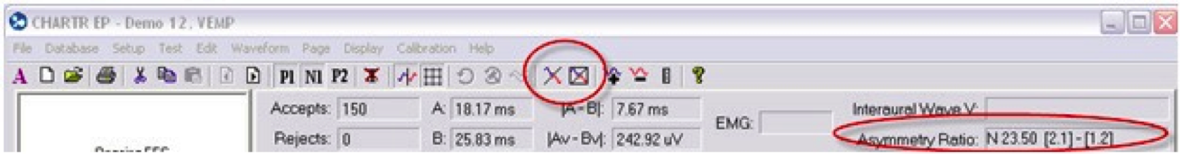 CHARTR EP toolbar indicating the asymmetry icon and the asymmetry ratio