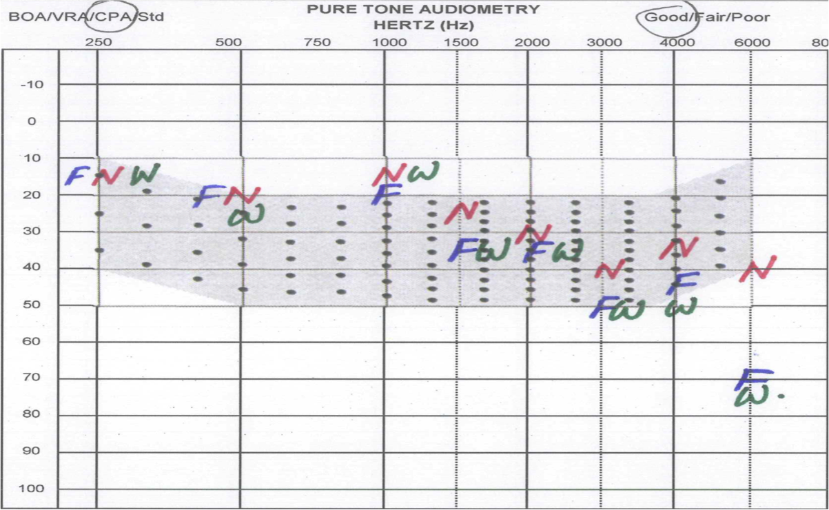 Audiogram used to collect data