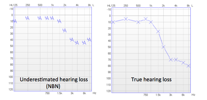 Thresholds obtained with narrowband noise stimulus and with pure tone stimulus for the same ear