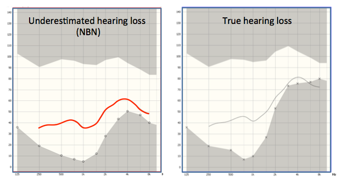 DSL5 targets for audiogram obtained with narrowband noise stimulus